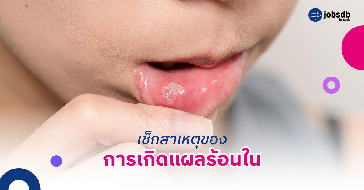 เช็กสาเหตุของการเกิดแผลร้อนใน