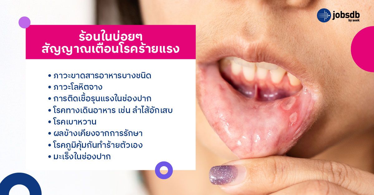 ร้อนในบ่อยๆ สัญญาณเตือนโรคร้ายแรง