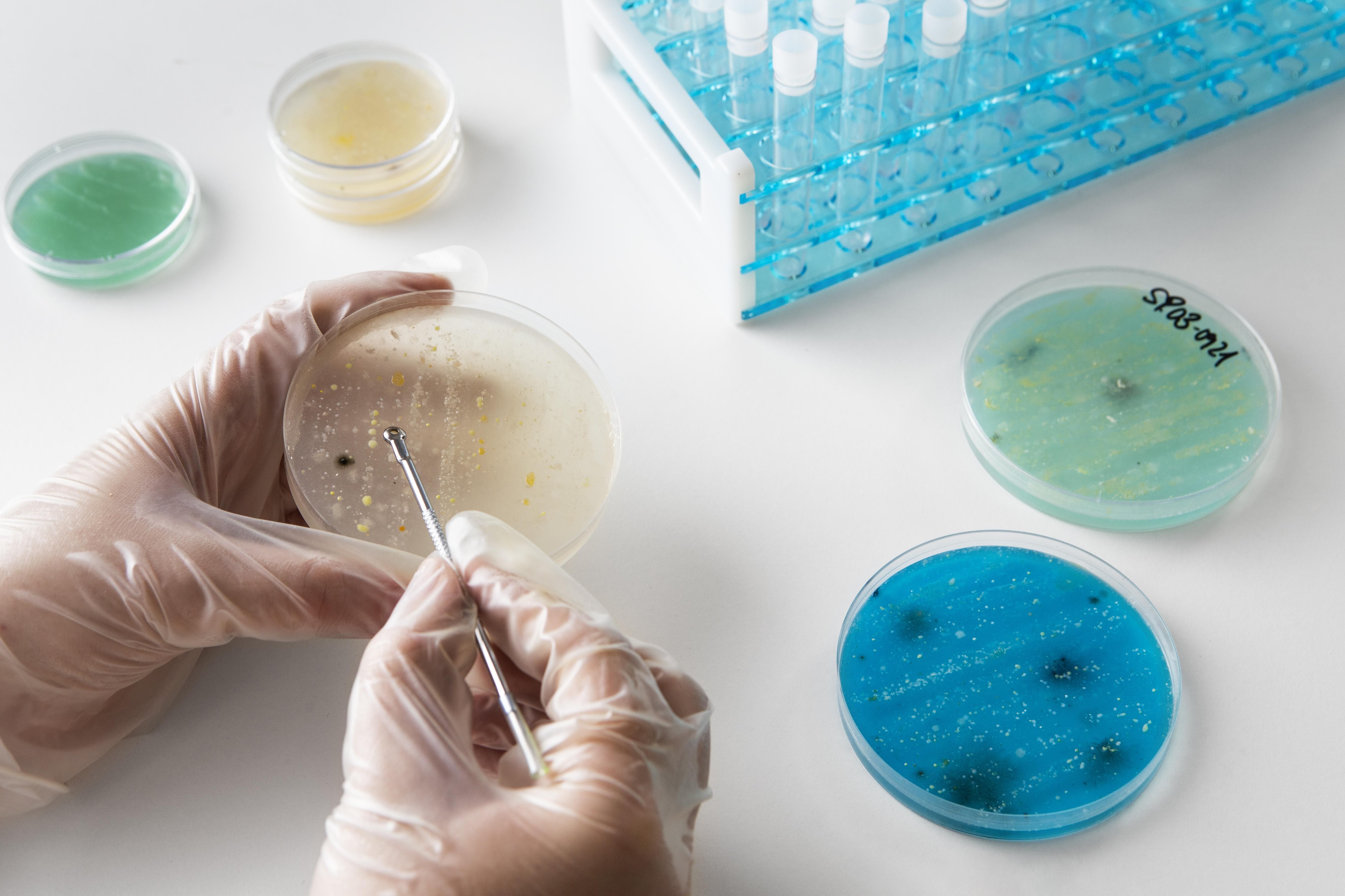 A pathologist wearing disposable gloves examines a petri dish containing bacterial cultures.